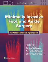 Minimally Invasive Surgery in Foot and Ankle: A Percutaneous Approach 1975198700 Book Cover