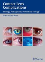 Contact Lens Complications: Etiology, Pathogenesis, Prevention, Therapy 3131277912 Book Cover