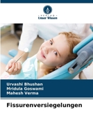 Fissurenversiegelungen 6209509436 Book Cover