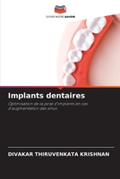 Implants dentaires: Optimisation de la pose d'implants en cas d'augmentation des sinus 6206001539 Book Cover