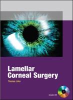 Lamellar Corneal Surgery 0071601929 Book Cover