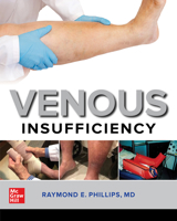 Venous Insufficiency 1260461262 Book Cover