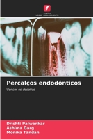 Percalços endodônticos: Vencer os desafios 6205869454 Book Cover