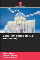 Canal em forma de C e seu manejo (Portuguese Edition) 6630095545 Book Cover