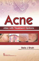 Acne Atlas with Treatment Options 938708504X Book Cover