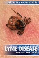 Lyme Disease: When Ticks Make You Sick 1534563644 Book Cover