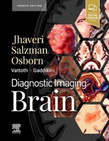 Diagnostic Imaging: Brain 0323756204 Book Cover