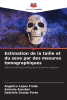 Estimation de la taille et du sexe par des mesures tomographiques (French Edition) 6207750543 Book Cover