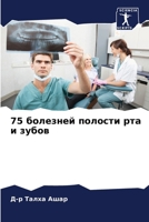 75 болезней полости рта и з 6207796837 Book Cover