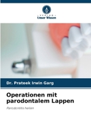 Operationen mit parodontalem Lappen (German Edition) 6209994288 Book Cover