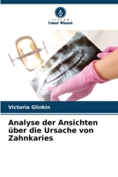 Analyse der Ansichten über die Ursache von Zahnkaries 6205681013 Book Cover