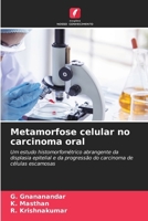 Metamorfose celular no carcinoma oral (Portuguese Edition) 6208908809 Book Cover