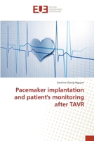 Pacemaker implantation and patient's monitoring after TAVR 3841615074 Book Cover