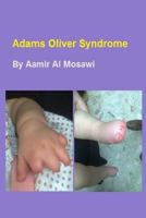 Adams Oliver syndrome: Clinical genetics 1727678362 Book Cover