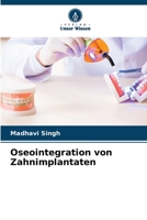 Oseointegration von Zahnimplantaten 6205253488 Book Cover