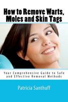 How to Remove Warts, Moles and Skin Tags: Your Comprehensive Guide to Safe and Effective Removal 1456481630 Book Cover