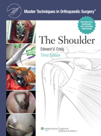 The Shoulder 0781797489 Book Cover