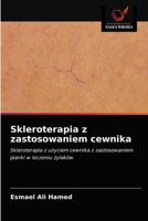 Skleroterapia z zastosowaniem cewnika 6203076651 Book Cover