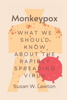 Monkeypox: What we should know about the rapidly spreading virus B0B8VLQL43 Book Cover