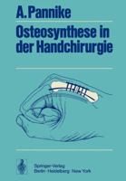 Osteosynthese in Der Handchirurgie 3642654282 Book Cover