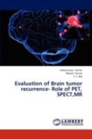 Evaluation of Brain tumor recurrence- Role of PET, SPECT,MR 3838354702 Book Cover