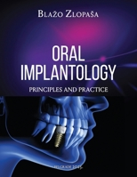 Oral Implantology: Principles and Practice 196742148X Book Cover