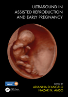 Ultrasound in Assisted Reproduction and Early Pregnancy 1138485853 Book Cover