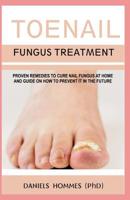 Toenail Fungus Treatment: Proven Remedies to Cure Nail Fungus at Home and Guide on How to Prevent It in the Future 1076855377 Book Cover