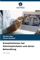 Komplikationen bei Zahnimplantaten und deren Behandlung (German Edition) 6630420675 Book Cover