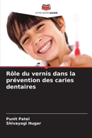 Rôle du vernis dans la prévention des caries dentaires 6207625544 Book Cover