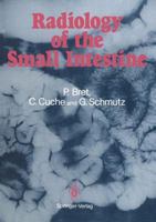 Radiology of the small intestine 2817808932 Book Cover