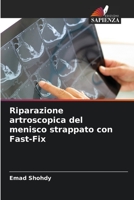 Riparazione artroscopica del menisco strappato con Fast-Fix 6204703536 Book Cover