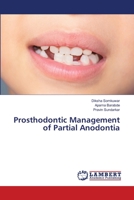 Prosthodontic Management of Partial Anodontia 6203306584 Book Cover