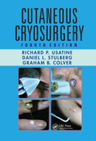 Cutaneous Cryosurgery: Principles and Clinical Practice 1032243023 Book Cover