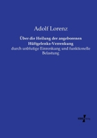 Über die Heilung der angeborenen Hüftgelenks-Verrenkung: durch unblutige Einrenkung und funktionelle Belastung 3737211183 Book Cover