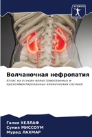 Волчаночная нефропатия 6204100483 Book Cover