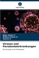 Virosen und Parodontalerkrankungen 6203309362 Book Cover
