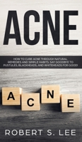 Acne: How to Cure Acne through Natural Remedies and Simple Habits. Say Goodbye to Pustules, Blackheads and Whiteheads for Good! 195108344X Book Cover