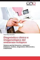 Diagnostico Clinico E Imagenologico del Embarazo Ectopico 3848462125 Book Cover
