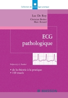 ECG pathologique: de la théorie à la pratique, 140 tracés (French Edition) 2294013166 Book Cover