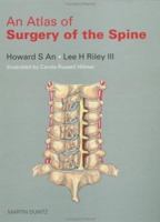 An Atlas of Surgery of the Spine 1853172189 Book Cover