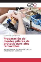 Preparacion de Dientes Pilares de Protesis Parciales Removibles 3639732685 Book Cover