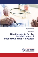Tilted Implants for the Rehabilitation of Edentulous Jaws - a Review 6203464686 Book Cover