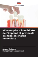 Mise en place immédiate de l'implant et protocole de mise en charge immédiate (French Edition) 6208533341 Book Cover