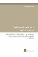 Split Hand/Split Foot Malformation 3838125541 Book Cover