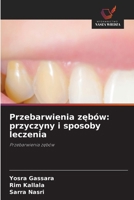 Przebarwienia zebów: przyczyny i sposoby leczenia (Polish Edition) 6630497996 Book Cover