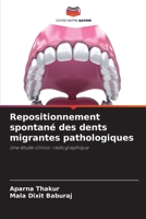 Repositionnement spontan� des dents migrantes pathologiques 6204106260 Book Cover