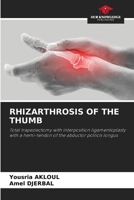 Rhizarthrosis of the Thumb 6207556062 Book Cover