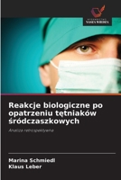 Reakcje biologiczne po opatrzeniu tętniaków śródczaszkowych 6209458351 Book Cover