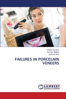 Failures in Porcelain Veneers 6207470354 Book Cover